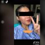 Sudah Lulus Psikotes, Wanita Ini Gagal Diterima Kerja karena Jerawat
