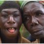 Dijuluki Mowgli, Zanziman Ellie Pilih Tinggal di Hutan Karena Di-bully