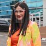 Titi DJ Blak-blakan Soal Sakit Autoimun, Nyerang Bagian Kulitnya