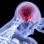 Revolusi Perawatan Saraf: Teknologi Neurofisiologi Terbaru di Indonesia