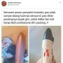 Penampakan Paket Isi Alat Penyedot Komedo Ini Bikin Kurir Salah Fokus