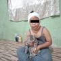 Dicakar Kucing sampai Wajah Luka dan Kesakitan, Kisah Bocah Ini Bikin Haru