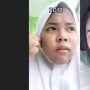 Kisahnya Viral, Remaja Ini Ungkap Rahasia Wajah Glowing Bebas Jerawat