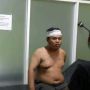 Pemuda Dibacok di Jalan Tengku Umar, Kepala Robek