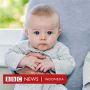 Akankah Jumlah Anak Kembar Semakin Berkurang di Masa Depan?