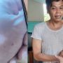 Ngeri! Warga Tangsel Digigit Kobra, Terasa Melepuh dan Tangan Mati Rasa