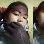 Wajah dan Tangan Hangus, Wanita Ini Bagikan Kisah Memilukan