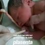 Viral Bayi Pegang Erat Tali Pusatnya Sesaat Setelah Dilahirkan, Gemes!