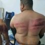 Gara-gara Berpuasa, 2 Orang Satpam Dianiaya Majikan hingga Babak-belur