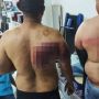 Kejam! Majikan Aniaya dan Todong Pistol ke Karyawan karena Puasa