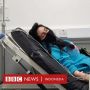 Penyakit Langka SMAS Membuat Perempuan Inggris Alami Kesakitan Mengerikan