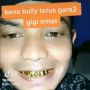 Viral! Semua Gigi Diganti Emas, Pria Ini Dibully Habis-Habisan