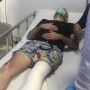 Gara-gara Sampah, Turis Italia Digebuki Sampai Kaki Patah di Kuta Bali