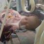 Alhamdulillah Donasi Terkumpul, Bayi Tanpa Lubang Anus Bisa Operasi