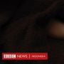 Bayi Kembar 9 Dilahirkan Perempuan Mali, Hanya 7 Terlihat di Pemindai