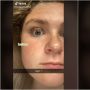 Viral di Tiktok: Gara-Gara Serum, Wanita Ini Menyesal Bulu Mata Berubah Mirip Laba-Laba