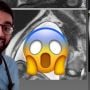 Dokter Bagikan Wujud Seram Janin Saat MRI, Kayak Monster!