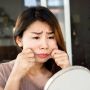 Tanam Benang agar Pipi Tirus, Wajah Wanita Ini Malah Berakhir Rusak
