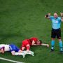 Rongga Matanya Retak, Bek Sayap Belgia Tinggalkan Euro 2020