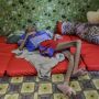 Anak Suku Baduy Alami Gizi Buruk dan TBC, Kini Dirujuk Relawan ke RSUD Banten
