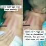 Viral Ibu Curhat Tak Tega Bayinya Dikerok Karena Sakit, Tuai Kritikan