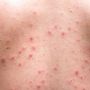 Pengertian Skin Barrier dan Manfaat Melindungi Kulit dari Sinar UV Hingga Kimia