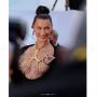 Bella Hadid Menyesal Operasi Plastik Sejak Usia 14 Tahun, Ahli Ungkap Risiko Tindakan Ini pada Remaja!