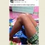 Warga Natuna Ngaku Bentol Mirip Biduran Usai Vaksinasi Covid-19, Satgas: Itu Alergi