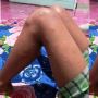Kaki Anak di Natuna Bentol-bentol usai Divaksin, Ini Kata Satgas Covid-19