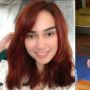 5 Foto Terbaru Feby Febiola, Berubah Drastis karena Idap Kanker Ovarium