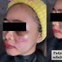Viral Wajah Pengantin Babak Belur Jelang Pernikahan, Hasil Riasan MUA Jadi Sorotan