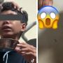 Viral Keluhkan Sering Mimisan, Ternyata Ada Sesuatu Bersarang di Hidung Remaja Ini!