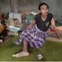 Bikin Pilu! Kisah Sutardi, Kena Eksim Parah, Hanya Bisa Beraktivitas di Tempat Tidur
