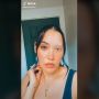 Sempat Nggak Pede, Ibu Ini Malah Viral karena Alis dan Bulu Mata Putih Sebelah