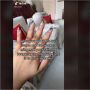 Kulit Pecah-pecah Parah, Curhat Wanita Diejek Pegawai Salon saat Hendak Manikur