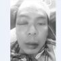 Ryan Jombang Dikeroyok di Depan Lapas, Babak Belur, Hidung Retak, Bibir Pecah
