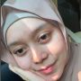 Intip 5 Potret Pesona Dinda Hauw dan Lesti Kejora Tanpa Make Up