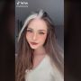 Rambut Sudah Beruban di Umur 22, Wanita Ini Dulu Diejek tapi Kini Malah Jadi Tren