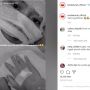 Seluruh Wajah Nissa Sabyan Diperban Akibat Jerawat, Netizen: Kirain Sinetron Azab