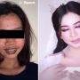 Transformasi Wajah Perempuan Penuh Noda Hitam Jadi Cantik Bak Princess Ini, Banjir Pujian