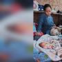 Bayi Lahir Tanpa Tempurung di Sukabumi, Ternyata Sudah Ada Tiga Kasus