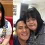 Jarang Tersorot, 7 Potret Chitra Adik Choky Sitohang yang Berkebutuhan Khusus