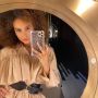 Gara-gara Filter di Medsos, Model Ini Menyesal Habiskan Rp250 Juta untuk Filler