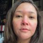 Idap Penyakit Kulit Bawaan, Ini Deretan Perawatan Wajah yang Dilakukan Maia Estianty