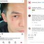 Wajah Jonathan Frizzy Luka, Benny Simanjuntak: Anak Saya Ijonk