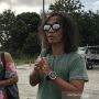 Cerita Kaka Slank yang Sempat Alami Kebotakan, Kini Rutin Creambath Hingga Lakukan Tranplantasi Rambut