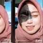 Viral Ika Masriana, TikTokers Punya Tanda Hitam di Wajah Dibully Mirip Monyet