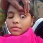 Viral! Gadis India Ini Mengaku Nangis Batu Selama Dua Bulan, Bagaimana Faktanya?