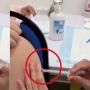 Viral Bocah 12 Tahun Dapat Suntikan Vaksin Kosong