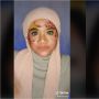 Sering Diejek karena Giginya, Respons Beauty Vlogger Ini Sukses Bikin Terharu